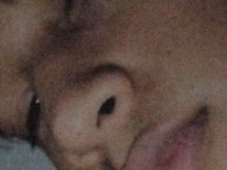 hares mds