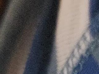 T0Yforeskin